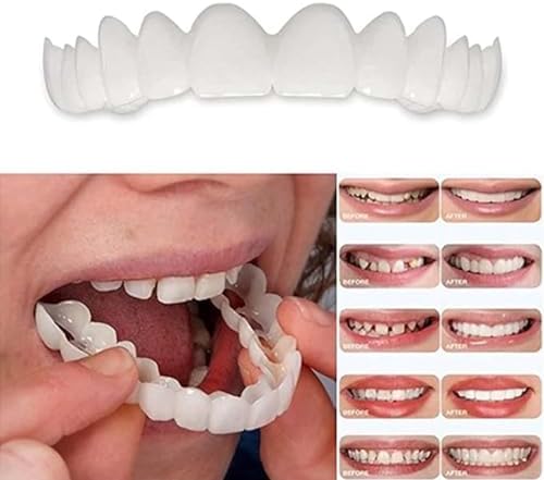 2 Pairs, Adjustable for Men and Women, Top and Bottom, Beautiful Smile