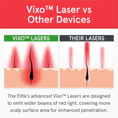 iRestore Elite - Laser Red Light Therapy for Hair Growth System - FDA Cleared Hair Loss, Hair Thinning & Alopecia Treatment for Men & Women - Laser Cap for Hair Regrowth Stimulates Denser Fuller Hair
