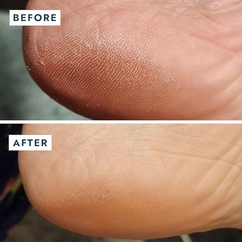VOESH Solemate Heel Repair Balm, Heel Moisturizer & Repair, Balm for Rough and Cracked Heels, Foot Care