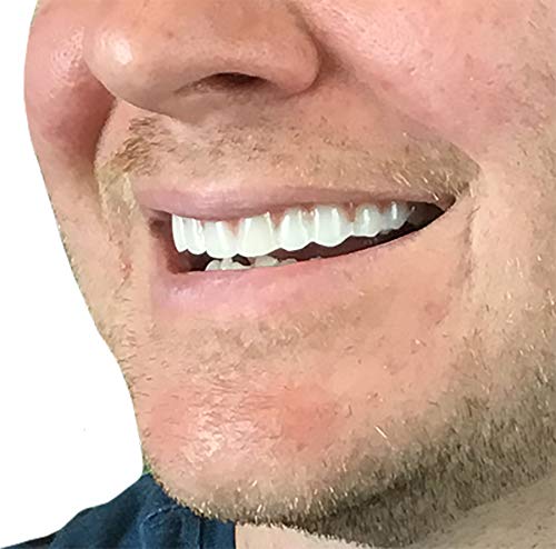 2 Pack - Instant Smile Natural Shade Comfort Fit Flex Veneers - Fix Your Smile from The Comfort of Your own Home in just Minutes! Hand Crafted