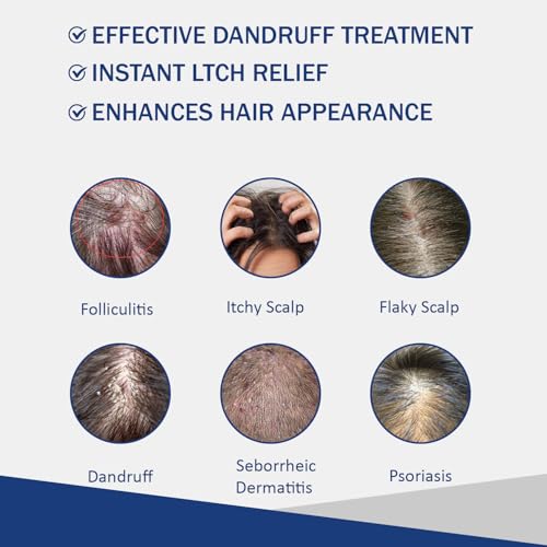 Sulfate Free - Anti Fungal Folliculitis Treatment Shampoo With Formula for Prone to Folliculitis,Seborrheic Dermatitis,For Normal to Oily Scalp Relieves Itchy & Dry Scalp, Dandruff - 10.1 Oz