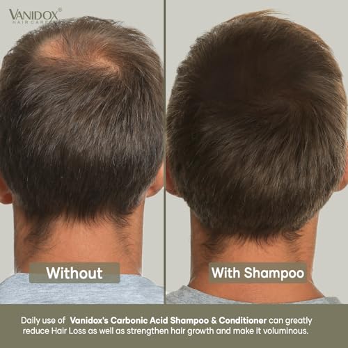 Carbonic Acid Shampoo and Conditioner for Men and Women, Deep Moisturizing Conditioner, Thickens, Softens, & Smooths Set for Hair Growth and Repair, Made in USA - 16 Fl Oz Each