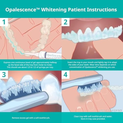 Opalescence 35% CP Mint - Gel Syringes Teeth Whitening - Refill Kit (2 Packs / 4 Syringes Total) Carbamide Peroxide Gel. Made by Ultradent. Tooth Whitening Refill Syringes with Toothbrush. 5197-2tb