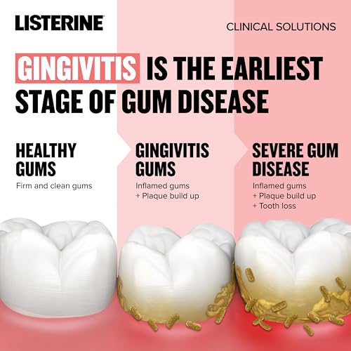Listerine Clinical Solutions Gum Health Antiseptic Mouthwash, Antigingivitis & Antiplaque Oral Rinse Helps Prevent Buildup & Kills Germs for Healthier Gums, ICY Mint, Twin Pack, 1 L, 2 Pack