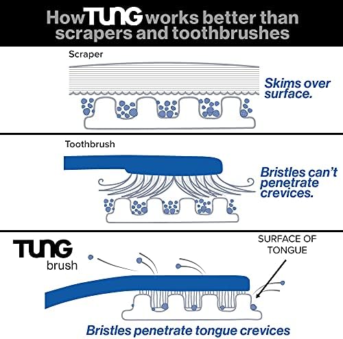 Tung Tongue Gel | Fresh Mint Tongue Cleaning Paste | Bad Breath and Halitosis | Mouth Odor Eliminator | Use with Tongue Brushes & Scrapers | Made in America (2 Pack)