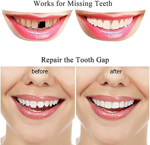 Tooth Repair Kit-Thermal Beads for Filling Fix The Missing and Broken Tooth or Adhesive The Denture Fake Teeth