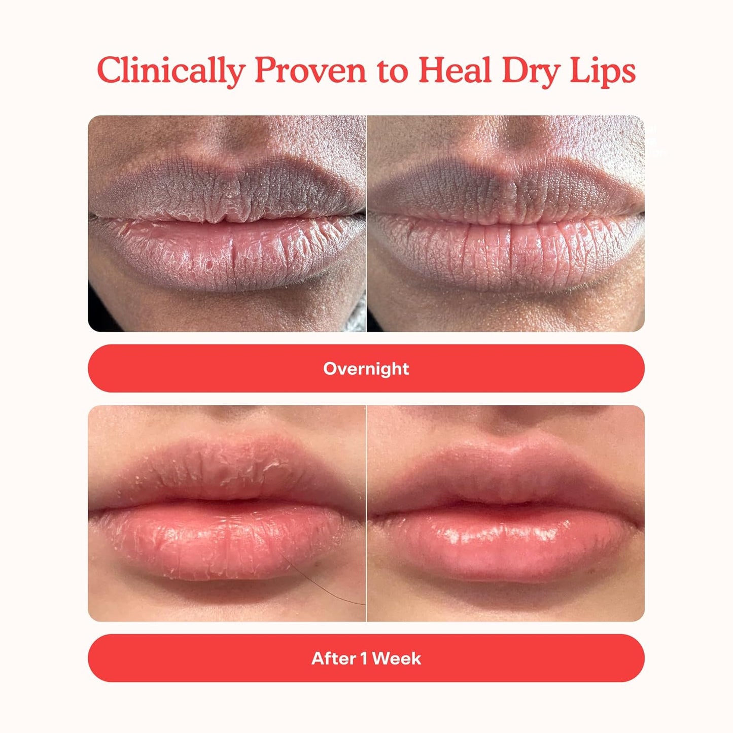 Tower 28 LipSoftie Hydrating Lip Treatment Balm, Moisturizing Lip Mask for Chapped Lips - SOS Vanilla Flavor, Clear Gloss