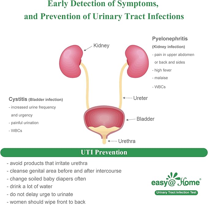 Easy@Home 50 Individual Pouch Urinary Tract Infection Test Strips, UTI Urine Testing Kit for Urinalysis and Detection of Leukocytes and Nitrites (UTIPOUCH-50P)